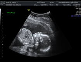 2-d-ultrasound