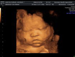 40d-ultrasound